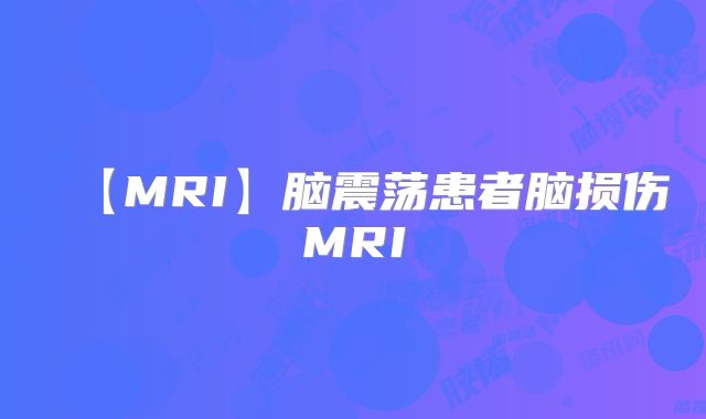 【MRI】脑震荡患者脑损伤MRI