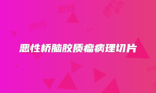 恶性桥脑胶质瘤病理切片