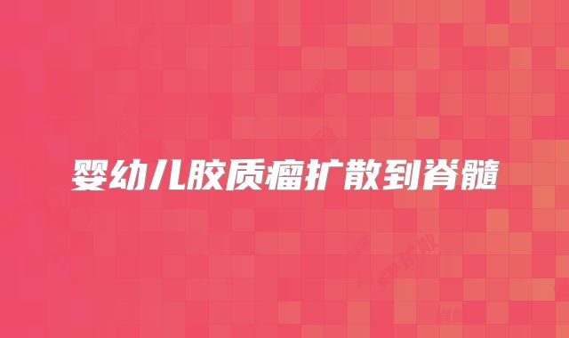 婴幼儿胶质瘤扩散到脊髓