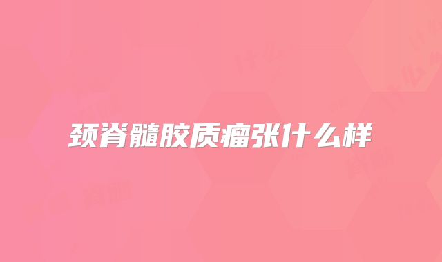 颈脊髓胶质瘤张什么样