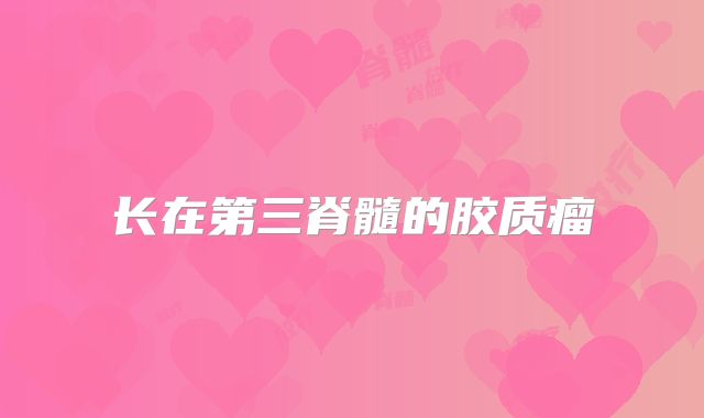 长在第三脊髓的胶质瘤