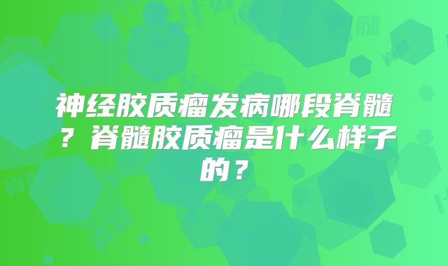 神经胶质瘤发病哪段脊髓？脊髓胶质瘤是什么样子的？