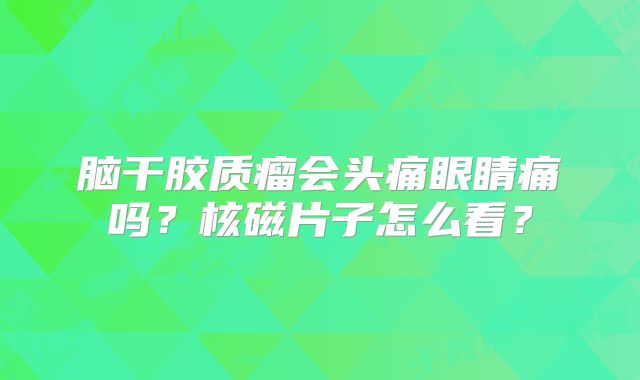 脑干胶质瘤会头痛眼睛痛吗？核磁片子怎么看？