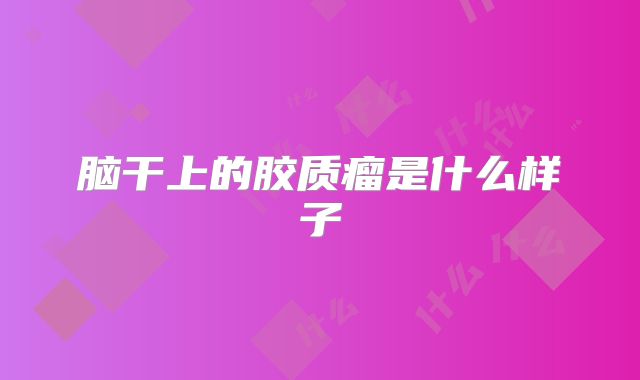脑干上的胶质瘤是什么样子