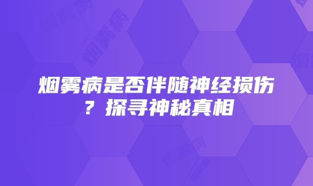 烟雾病是否伴随神经损伤？探寻神秘真相