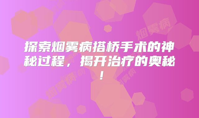 探索烟雾病搭桥手术的神秘过程，揭开治疗的奥秘！