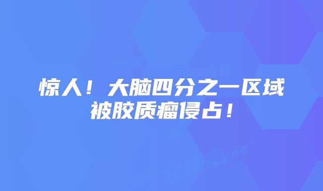 惊人！大脑四分之一区域被胶质瘤侵占！