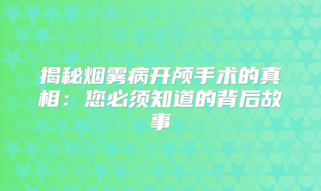 揭秘烟雾病开颅手术的真相：您必须知道的背后故事