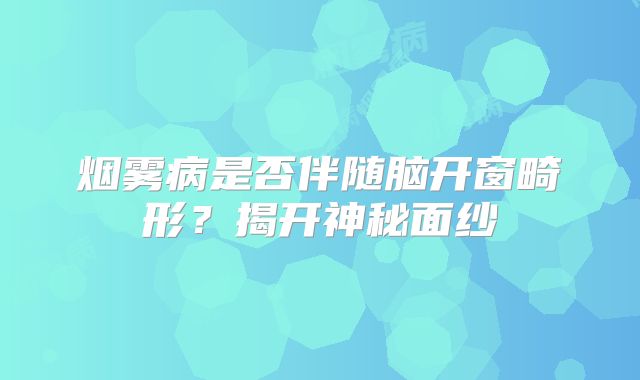 烟雾病是否伴随脑开窗畸形？揭开神秘面纱