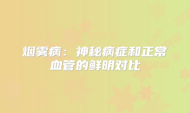烟雾病：神秘病症和正常血管的鲜明对比