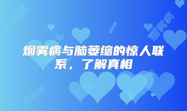 烟雾病与脑萎缩的惊人联系，了解真相