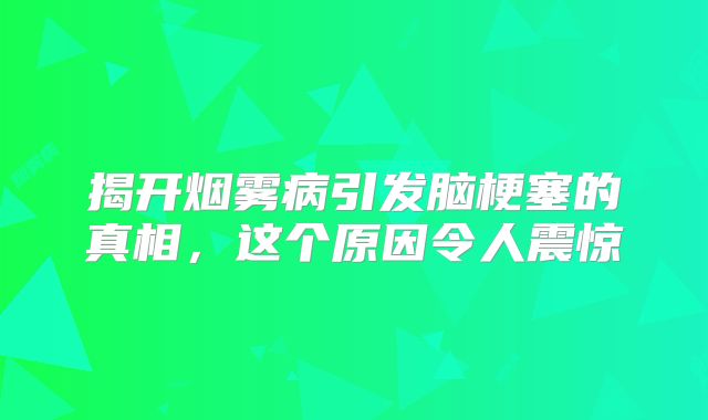 揭开烟雾病引发脑梗塞的真相，这个原因令人震惊