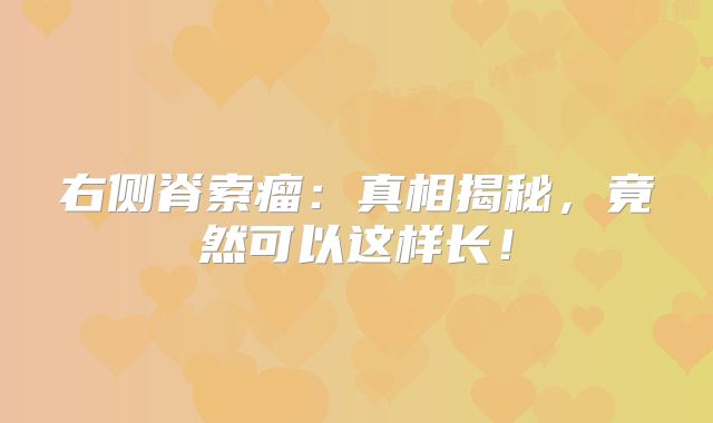右侧脊索瘤：真相揭秘，竟然可以这样长！