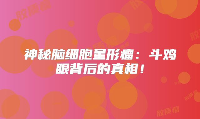 神秘脑细胞星形瘤：斗鸡眼背后的真相！