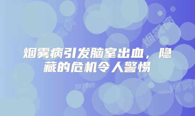 烟雾病引发脑室出血，隐藏的危机令人警惕