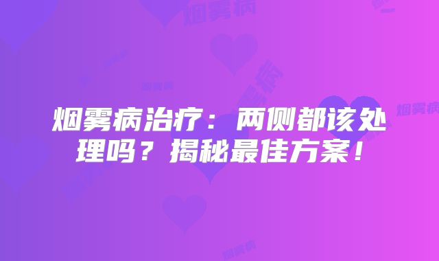 烟雾病治疗：两侧都该处理吗？揭秘最佳方案！
