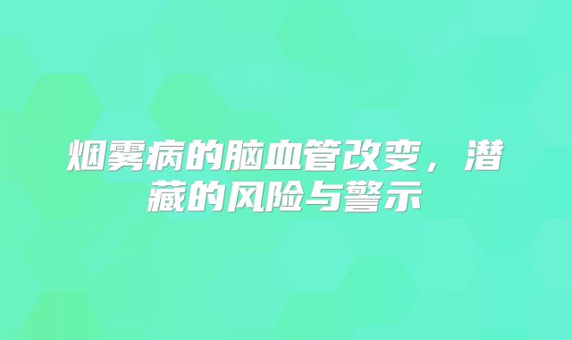 烟雾病的脑血管改变，潜藏的风险与警示