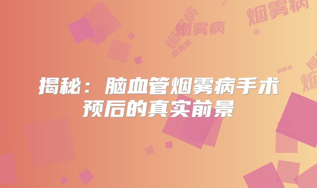 揭秘：脑血管烟雾病手术预后的真实前景