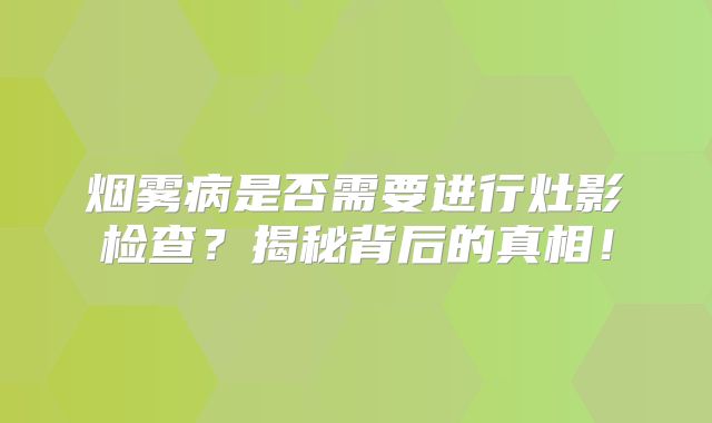 烟雾病是否需要进行灶影检查？揭秘背后的真相！