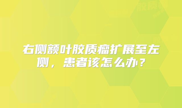 右侧额叶胶质瘤扩展至左侧，患者该怎么办？