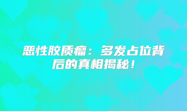 恶性胶质瘤：多发占位背后的真相揭秘！
