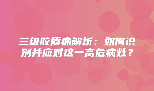 三级胶质瘤解析：如何识别并应对这一高危病灶？