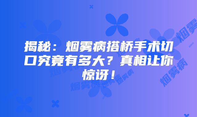 揭秘：烟雾病搭桥手术切口究竟有多大？真相让你惊讶！