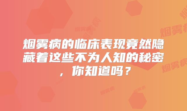 烟雾病的临床表现竟然隐藏着这些不为人知的秘密，你知道吗？