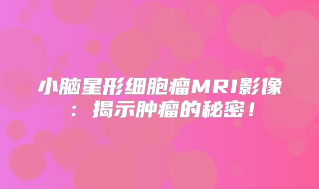 小脑星形细胞瘤MRI影像：揭示肿瘤的秘密！