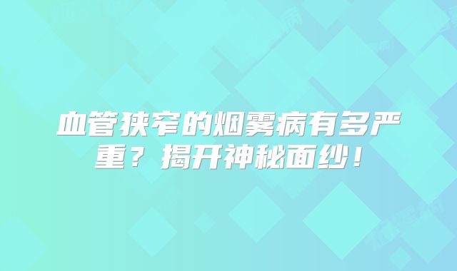 血管狭窄的烟雾病有多严重？揭开神秘面纱！