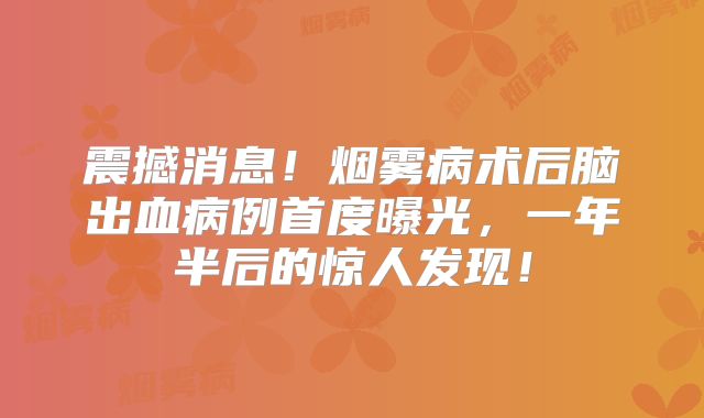 震撼消息！烟雾病术后脑出血病例首度曝光，一年半后的惊人发现！