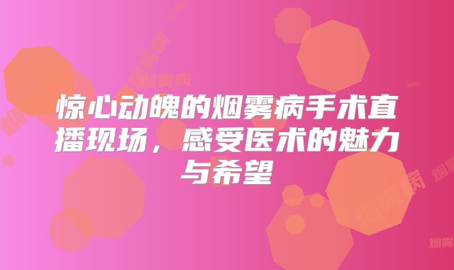 惊心动魄的烟雾病手术直播现场，感受医术的魅力与希望