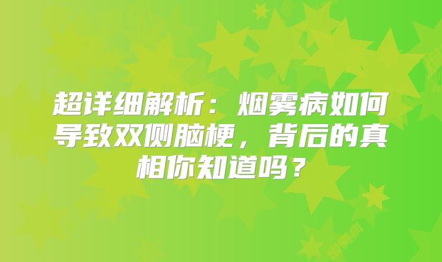 超详细解析：烟雾病如何导致双侧脑梗，背后的真相你知道吗？