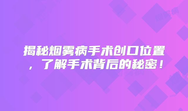 揭秘烟雾病手术创口位置，了解手术背后的秘密！