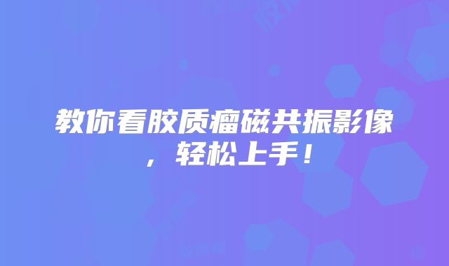 教你看胶质瘤磁共振影像，轻松上手！