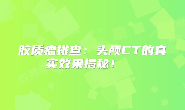 胶质瘤排查：头颅CT的真实效果揭秘！  