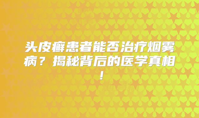 头皮癣患者能否治疗烟雾病？揭秘背后的医学真相！