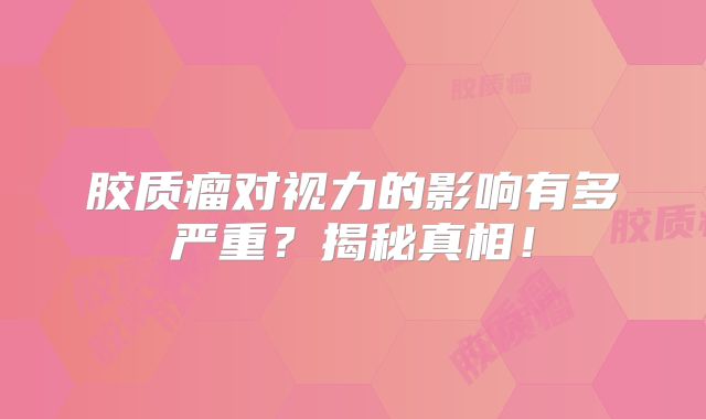 胶质瘤对视力的影响有多严重？揭秘真相！