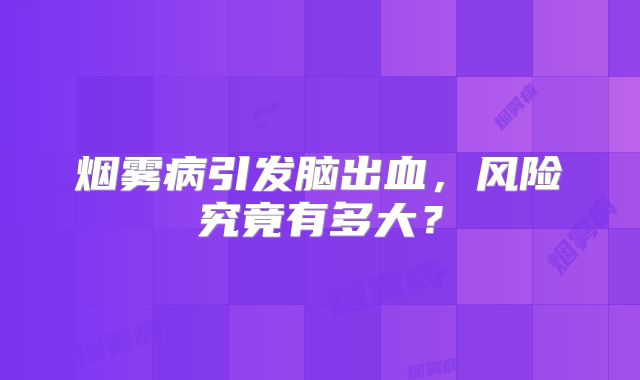烟雾病引发脑出血，风险究竟有多大？