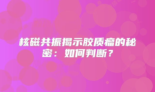 核磁共振揭示胶质瘤的秘密：如何判断？