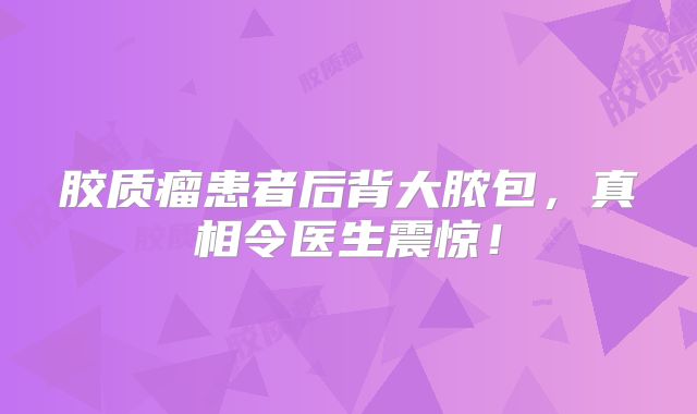 胶质瘤患者后背大脓包，真相令医生震惊！
