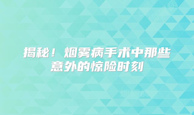 揭秘！烟雾病手术中那些意外的惊险时刻
