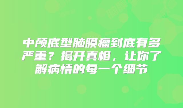 中颅底型脑膜瘤到底有多严重？揭开真相，让你了解病情的每一个细节