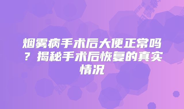 烟雾病手术后大便正常吗？揭秘手术后恢复的真实情况