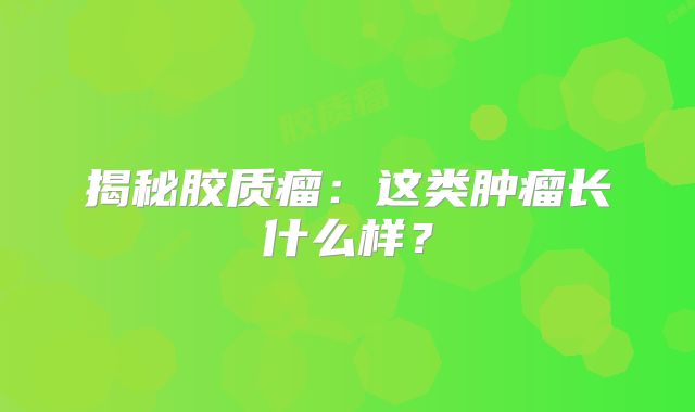 揭秘胶质瘤：这类肿瘤长什么样？