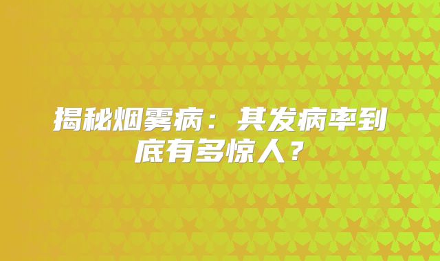 揭秘烟雾病：其发病率到底有多惊人？