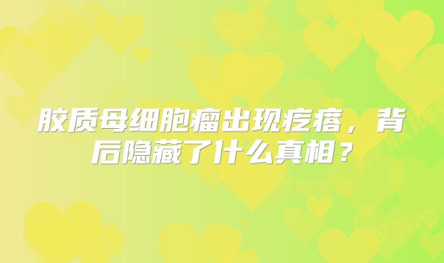 胶质母细胞瘤出现疙瘩，背后隐藏了什么真相？
