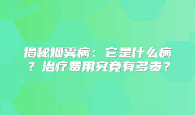 揭秘烟雾病：它是什么病？治疗费用究竟有多贵？