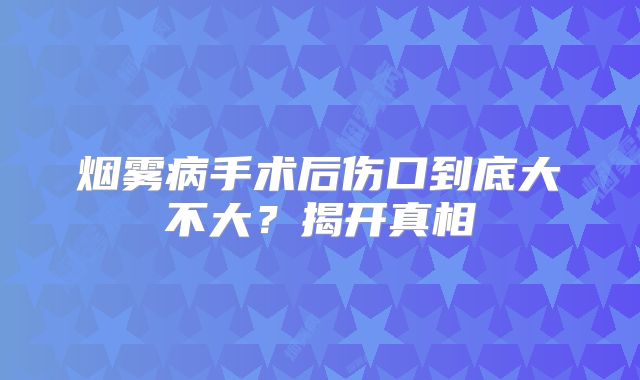 烟雾病手术后伤口到底大不大？揭开真相