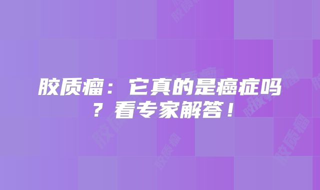 胶质瘤：它真的是癌症吗？看专家解答！